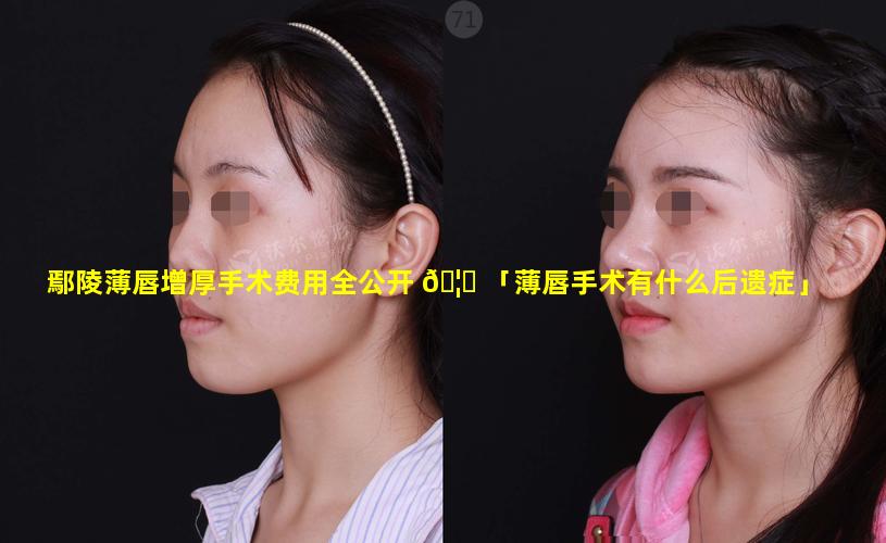 鄢陵薄唇增厚手术费用全公开 🦉 「薄唇手术有什么后遗症」